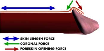 Physics of penile skin, part 1